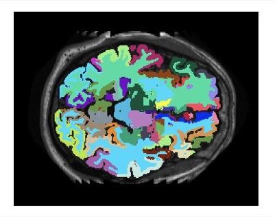 seminario Intelligenza artificiale e ricerca biomedica: stato attuale e prospettive”